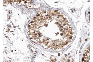 ABIN6268750 at 1/100 staining human testis tissue sections by IHC-P. (Patched 1 antibody)