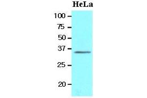 Cell lysates of HeLa(20 ug) were resolved by SDS-PAGE, transferred to nitrocellulose membrane and probed with anti-human BRCC36 (1:1000). (BRCC3 antibody  (AA 1-316))