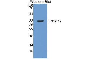 Detection of Recombinant PXN, Rat using Polyclonal Antibody to Paxillin (PXN) (Paxillin antibody  (AA 327-568))