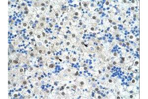 Image no. 1 for anti-Pre-mRNA Branch Site Protein p14 (SF3B14) (N-Term) antibody (ABIN203323) (Pre-mRNA Branch Site Protein p14 (SF3B14) (N-Term) antibody)
