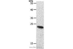 Western blot analysis of 231 cell, using RAMP2 Polyclonal Antibody at dilution of 1:650