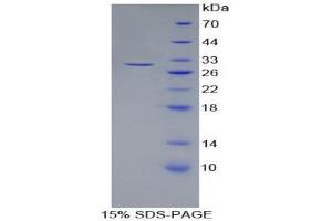 SDS-PAGE (SDS) image for Laminin, beta 3 (LAMB3) (AA 503-738) protein (His tag) (ABIN1878942) (Laminin beta 3 Protein (AA 503-738) (His tag))