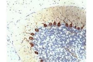 Purkinje Cells in rat cerebellum, formalin-fixed paraffin-embedded tissue, citrate pre-treatment, 40X. (PKC delta antibody  (AA 114-289))