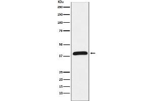 Western blot analysis of HIF1AN expression in Jurkat cell lysate.