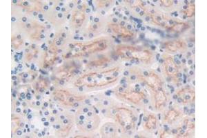 IHC-P analysis of Rat Prostate Gland Tissue, with DAB staining.