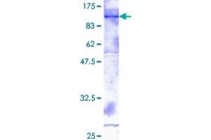 ADAM2 Protein (AA 1-716) (GST tag)