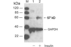 Western blot analysisLane 1: cell lysate of NIH/3T3 unstimulatedLane 2: cell lysate of NIH/3T3 stimulated with insulinPrimary Antibody: Rabbit Anti-Akt (Phospho-Ser473) Polyclonal Antibody (ABIN398632) Secondary Antibody: 0. (AKT1 antibody  (pSer473))
