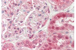 Rabbit Anti-TSC22D1 antibody Catalog Number: ARP36279 Formalin Fixed Paraffin Embedded Tissue: Human Kidney Primary antibody Concentration: 1:100 Secondary Antibody: Donkey anti-Rabbit-Cy3 Secondary Antibody Concentration: 1:200 Magnification: 20x Exposure Time: 0. (TSC22D1 antibody  (C-Term))