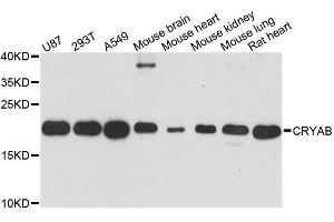 Western blot analysis of extracts of various cell lines, using CRYAB antibody. (CRYAB antibody)