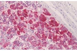 Human Pituitary, Anterior: Formalin-Fixed, Paraffin-Embedded (FFPE)