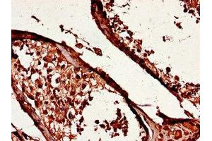 Immunohistochemistry of paraffin-embedded human testis tissue using ABIN7174080 at dilution of 1:100
