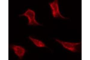 Immunofluorescence (fixed cells) (IF/ICC) image for anti-Tumor Protein P53 (TP53) (pSer366) antibody (ABIN6255262)
