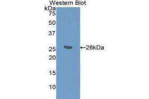Western Blotting (WB) image for anti-BH3 Interacting Domain Death Agonist (BID) (AA 1-195) antibody (ABIN3208215) (BID antibody  (AA 1-195))