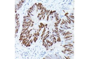 Immunohistochemistry of paraffin-embedded rat lung using GAPDH Mouse mAb (ABIN3020540, ABIN3020541, ABIN3020542 and ABIN1512934) at dilution of 1:100 (40x lens). (GAPDH antibody)