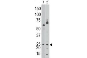 Western Blotting (WB) image for anti-BCL2/adenovirus E1B 19kDa Interacting Protein 3 (BNIP3) (BH3 Domain) antibody (ABIN2997216) (BNIP3 antibody  (BH3 Domain))