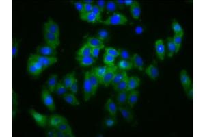 Immunofluorescence staining of HepG2 cells with ABIN7170267 at 1:133, counter-stained with DAPI. (SLC5A4 antibody  (AA 579-633))