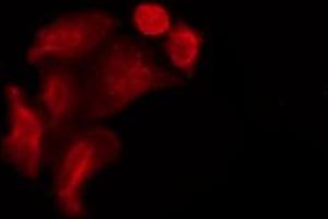 ABIN6267460 staining A549 by IF/ICC. (NOS1 antibody  (pSer852))