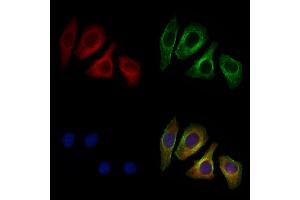 ABIN6262041 and ABIN6276973 staining Hela cells by IF/ICC. (Glypican 3 antibody  (N-Term))
