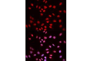 Immunofluorescence (IF) image for anti-ELK1, Member of ETS Oncogene Family (ELK1) (pSer383) antibody (ABIN1870156) (ELK1 antibody  (pSer383))