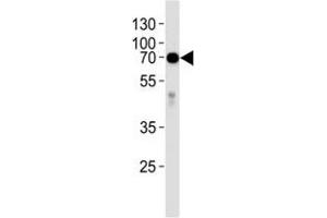 Western blot analysis of lysate from human placenta tissue lysate using anti-Alkaline Phosphatase antibody diluted at 1:1000. (Alkaline Phosphatase antibody  (AA 274-304))