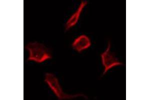 ABIN6266934 staining COLO205 by IF/ICC. (RNF144A antibody  (Internal Region))