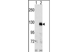 Western blot analysis of EphA3(arrow) using rabbit polyclonal EphA3 Antibody (C-term) (ABIN391888 and ABIN2841708). (EPH Receptor A3 antibody  (C-Term))