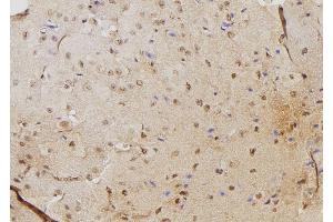 ABIN6264495 and ABIN6276345 at 1/100 staining Mouse brain tissue by IHC-P. (PSME3 antibody  (N-Term))