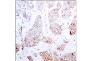 Image no. 1 for anti-V-Raf-1 Murine Leukemia Viral Oncogene Homolog 1 (RAF1) (Ser259) antibody (ABIN197103) (RAF1 antibody  (Ser259))