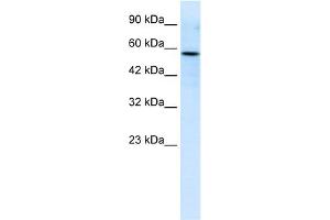 WB Suggested Anti-RIPX Antibody Titration:  0. (RUFY3 antibody  (C-Term))