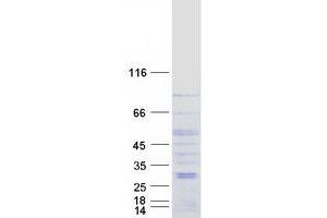 Validation with Western Blot (Bestrophin 3 Protein (BEST3) (Transcript Variant 2) (Myc-DYKDDDDK Tag))