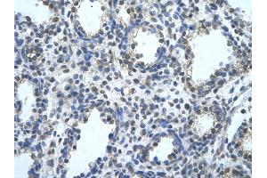Rabbit Anti-BLZF1 Antibody       Paraffin Embedded Tissue:  Human alveolar cell   Cellular Data:  Epithelial cells of renal tubule  Antibody Concentration:   4. (BLZF1 antibody  (C-Term))