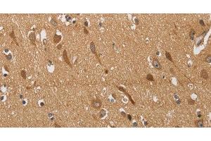 Immunohistochemistry of paraffin-embedded Human brain using KCNQ4 Polyclonal Antibody at dilution of 1:40 (KCNQ4 antibody)