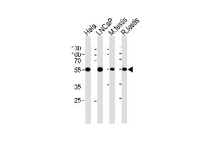 Western blot analysis of lysates from Hela, LNCaP cell line, mouse testis and rat testis tissue lysates(from left to right), using ULK3 Antibody (C-term) (ABIN6243328 and ABIN6577077). (ULK3 antibody  (C-Term))