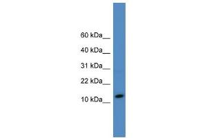 WB Suggested Anti-SLPI Antibody Titration: 0. (SLPI antibody  (N-Term))