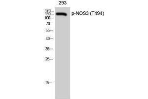 Western Blotting (WB) image for anti-Nitric Oxide Synthase 3 (Endothelial Cell) (NOS3) (pThr494) antibody (ABIN3182095) (ENOS antibody  (pThr494))