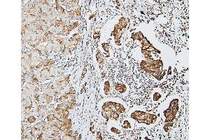 IHC analysis of DDR1 using anti-DDR1 antibody (ABIN7601407). (DDR1 antibody  (AA 341-909))