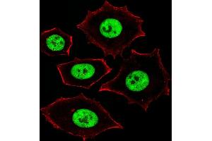 Fluorescent image of MCF-7 cells stained with ZN Antibody (Center) (ABIN1882027 and ABIN2843373). (Zinc Finger and SCAN Domain Containing 32 (ZSCAN32) (AA 159-187) antibody)