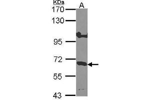 WB Image Sample (30 ug of whole cell lysate) A: Hep G2 , 7. (IL-10RA antibody)
