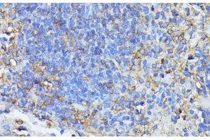 Immunohistochemistry of paraffin-embedded Mouse spleen using STK24 Polyclonal Antibody at dilution of 1:100 (40x lens).