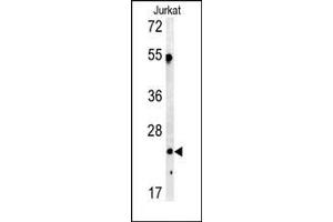 Western blot analysis of C1QA antibody (C-term) (ABIN391492 and ABIN2841459) in Jurkat cell line lysates (35 μg/lane).