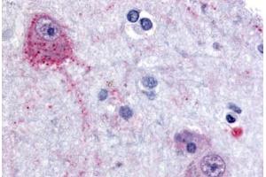 Anti-PACE4 antibody  ABIN1049226 IHC staining of human brain, cortex. (PCSK6 antibody  (Internal Region))
