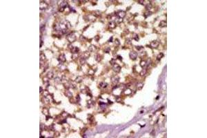 Image no. 2 for anti-BMX Non-Receptor Tyrosine Kinase (BMX) (Middle Region) antibody (ABIN359973) (BMX antibody  (Middle Region))