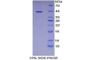 SDS-PAGE (SDS) image for Interleukin 12 Receptor, beta 2 (IL12RB2) (AA 559-647) protein (His tag,GST tag) (ABIN2123072)
