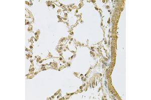 Immunohistochemistry of paraffin-embedded rat lung using PSMA5 Antibody (ABIN6292510) at dilution of 1:100 (40x lens).