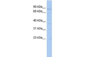 WB Suggested Anti-PCSK4 Antibody Titration: 0. (PCSK4 antibody  (N-Term))