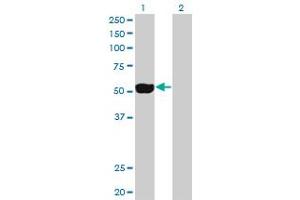 Western Blot analysis of NEK2 expression in transfected 293T cell line by NEK2 monoclonal antibody (M01), clone 2F6. (NEK2 antibody  (AA 331-445))