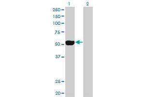 Western Blot analysis of NEK2 expression in transfected 293T cell line by NEK2 monoclonal antibody (M01), clone 2F6.