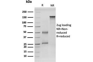 SDS-PAGE Analysis Purified RET-Monospecific Mouse Monoclonal Antibody (RET/2599).