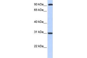 Human HeLa; WB Suggested Anti-ANKRA2 Antibody Titration: 0. (ANKRA2 antibody  (C-Term))