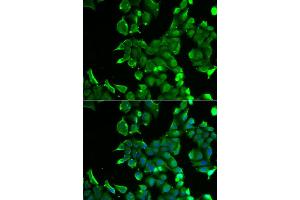 Immunofluorescence analysis of HeLa cell using STOM antibody. (Stomatin antibody)